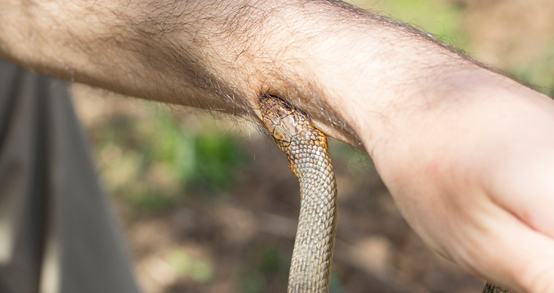 Snakebites | First Aid