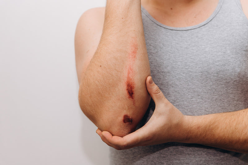 Puncture Wound | First Aid
