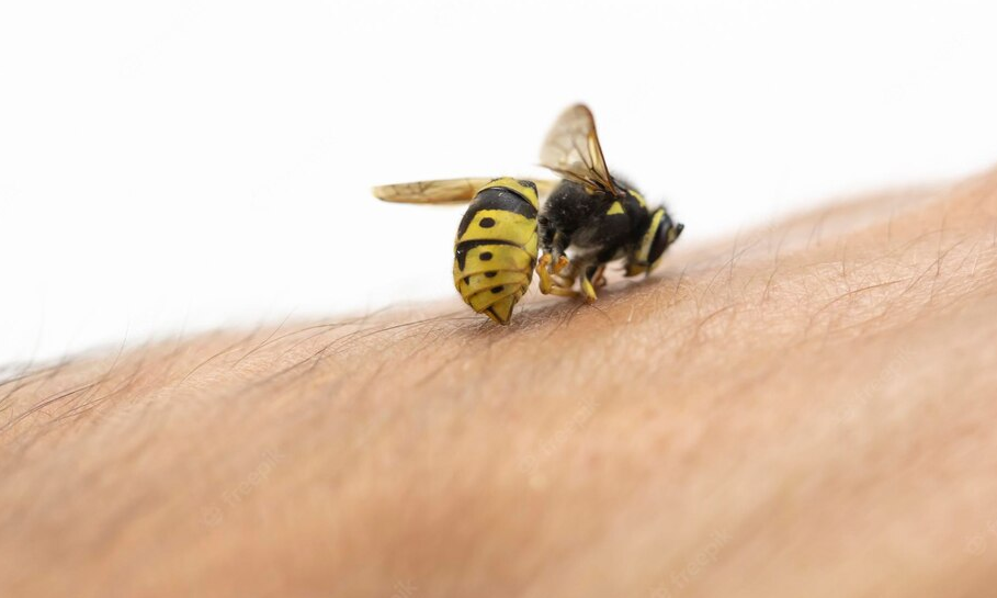Bites and Stings You Might Come Across This Summer