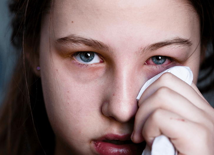 Take Aim at the Dreaded Pink Eye: Treating Conjunctivitis Swiftly, Seriously, and Safely - Aussie Pharmacy
